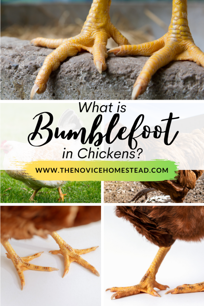 collage of chicken feet photos; text overlay "What is Bumblefoot in Chickens"